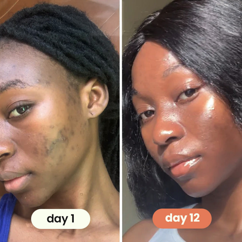 korean skincare anti-aging toner pads