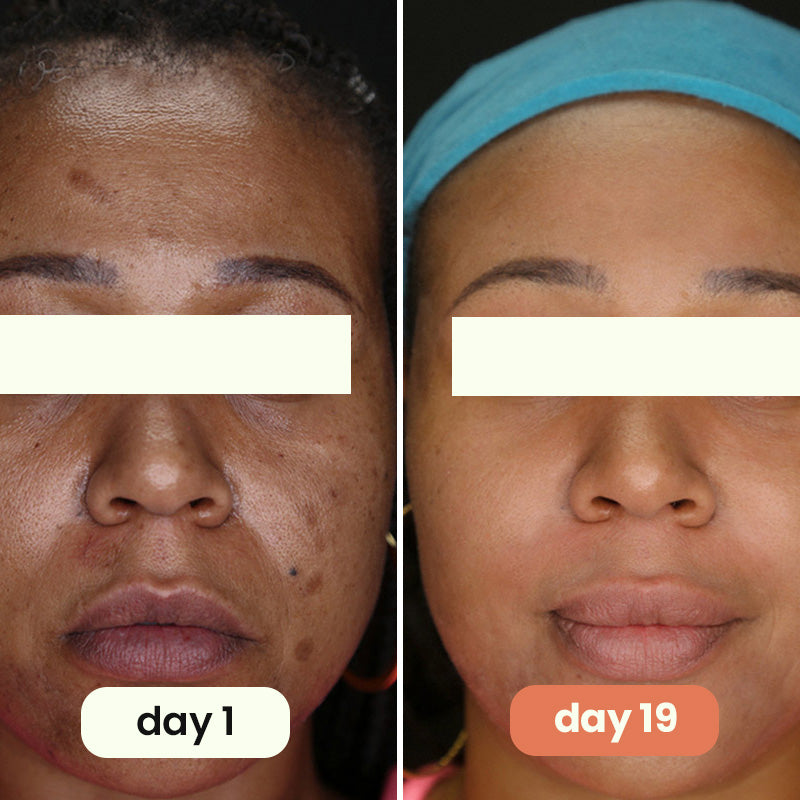 korean skincare anti-aging toner pads